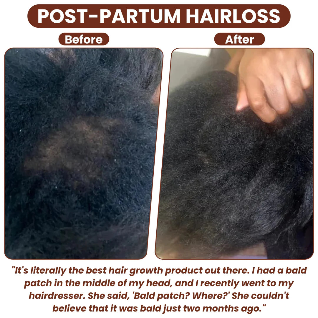 Loungys Pure Batana Oil